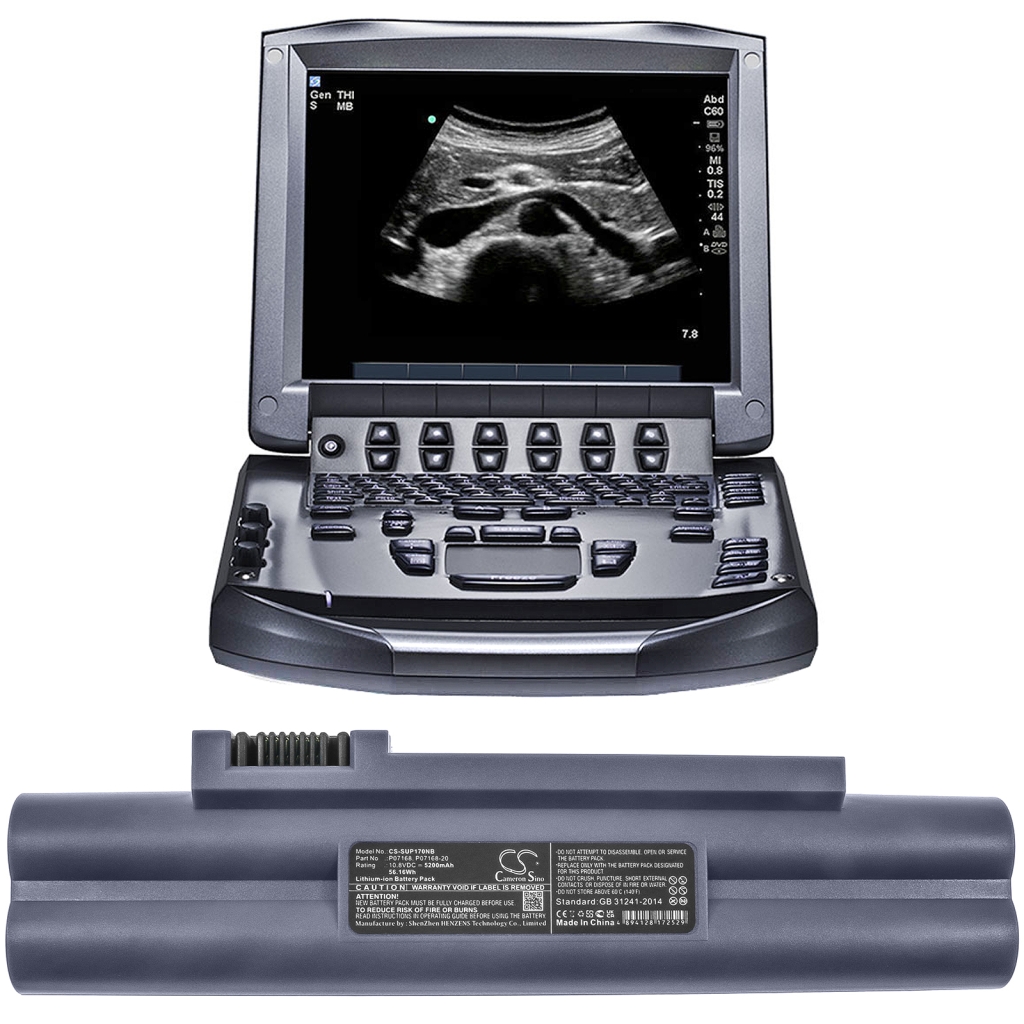 Sonosite M-Turbo